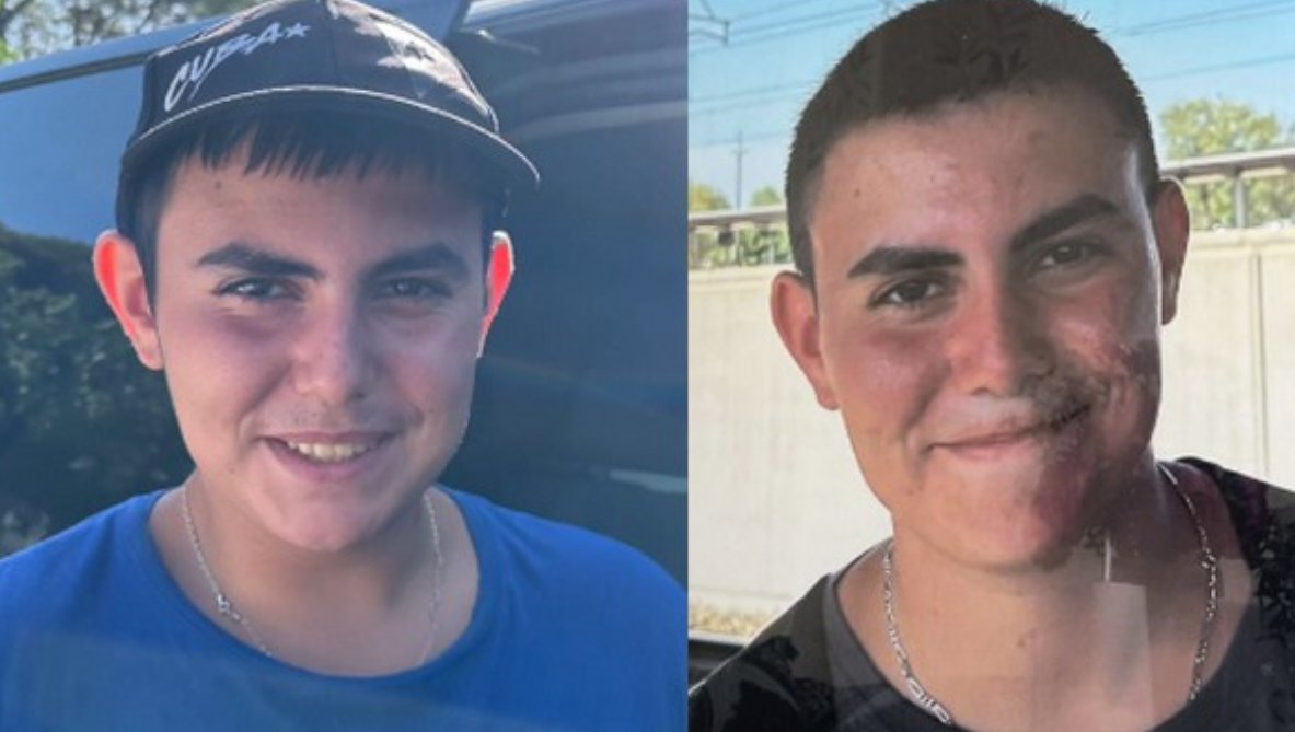 RadioRomaX's tweet photo. 🇨🇵 Yanis, 17 ans, met fin à ses jours après la remise en liberté de son agresseur sexuel

RadioRomaX actualités France 

Yanis, 17 ans, a mis fin à ses jours le 30 mars dernier après avoir appris la remise en liberté de l’homme qui l’avait agressé sexuellement lorsqu'il avait 12 ans.

Tout a commencé en septembre 2022 lorsque l'adolescent, alors âgé de 15 ans, avait alerté l’association Carl qui accompagne les enfants victimes de violences sexuelles et intrafamiliales.

Il avait lancé un appel à l’aide via le formulaire de contact de l’association et en message privé sur Instagram :

"Je vous écris ce message pour parler. Cela fait déjà trois ans, trois ans que je survis, que je souffre, que je me tais".

Par la suite, son agresseur avait été interpellé et condamné à 5 ans de prison ferme le 12 octobre 2023 devant le tribunal de Bonneville après avoir effectué précédemment un an de détention provisoire.

Cet homme était un voisin de Yanis et sa famille. "On s’entendait très bien avec lui. Il jouait avec les enfants…" avait témoigné Farid, le papa de Yanis.

A l'époque, il était déjà connu des services de police pour des faits d'agressions sexuelles sur mineurs commis en 2007 et en 2014.

Le 13 février 2025, Yanis a appris que son agresseur sexuel avait été remis en liberté sous bracelet électronique.

Le 30 mars, le jeune homme a été retrouvé inconscient au petit matin par sa soeur, avant qu’il ne décède dans une ambulance quelques heures plus tard. Les analyses sont claires : c’est un suicide.

Dans une lettre écrite retrouvée sur son téléphone portable, il explique son geste et évoque la remise en liberté de son prédateur sexuel. Il devait avoir 18 ans le 2 avril.

Un appel aux dons a été lancé sur le site de l'association HelloAsso pour "aider sa famille à lui dire adieu avec amour, respect et humanité." Plus de 24.000 € ont été récoltés