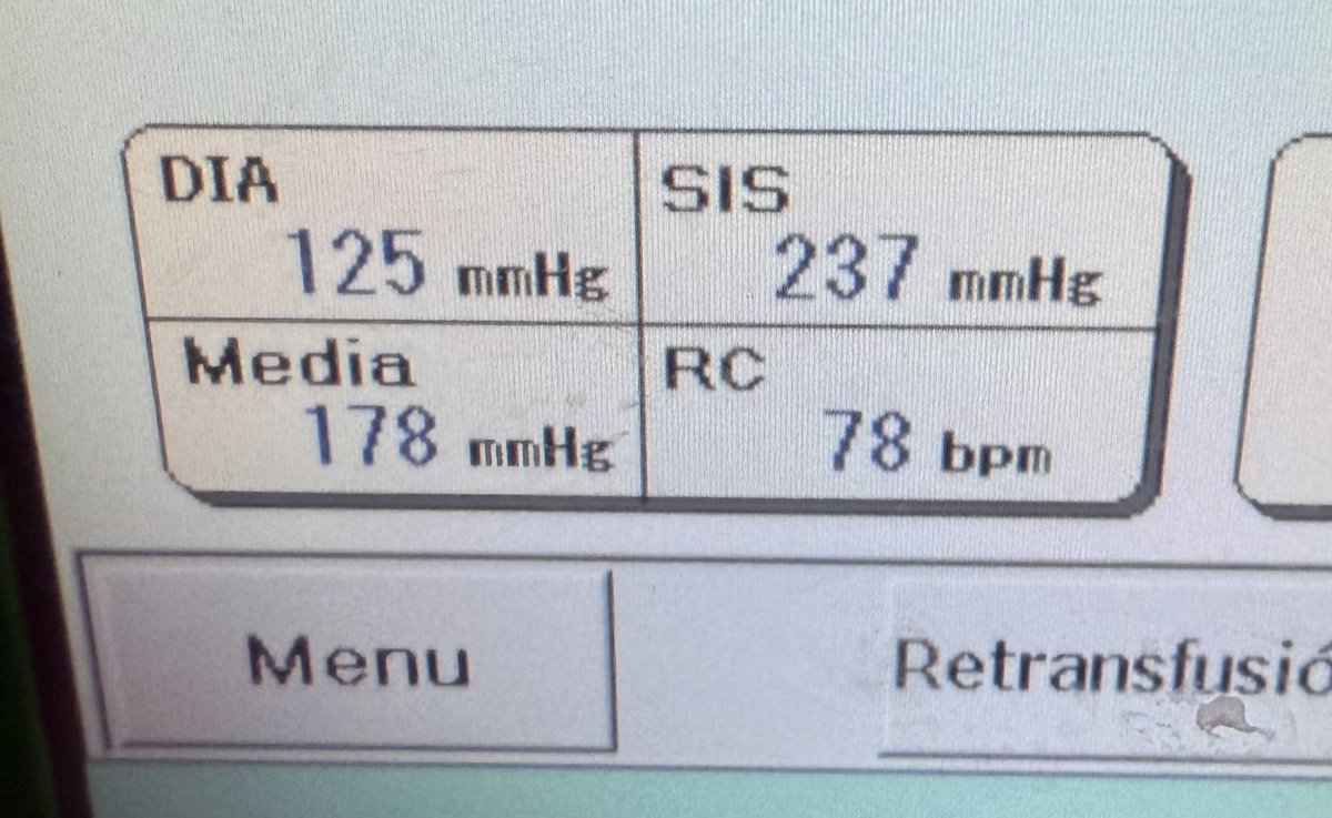 TA: 237/125 

No me tomo el medicamento por qué si no me baja la presión.

Cierto, que pendejo soy. Perdón.

Excelente fin de semana, no tome mucha coca