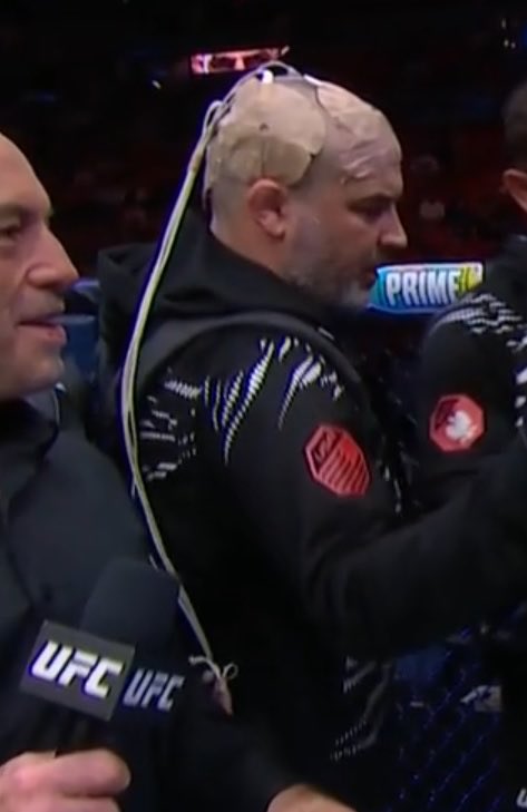 Say what you want about Sedriques Dumas—but his coach, Adam Hicks, deserves some serious respect 🙏🏼 

He’s currently battling brain cancer and still showing up in his corner. 

That’s a different level of strength 💪🏼 

GoFundMe: gofundme.com/f/support-adam…

📷: <a href="/jaypettry/">Jay Pettry</a>