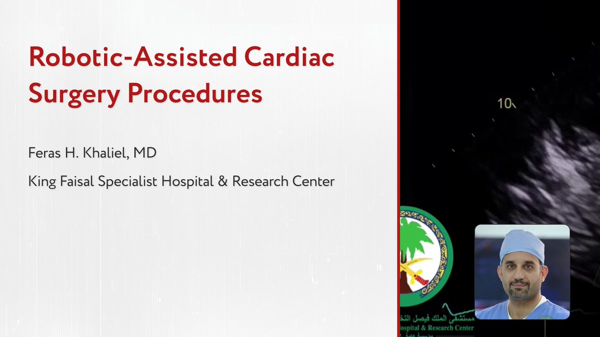 CTSNet (@ctsnetorg) on Twitter photo Robotic-Assisted Cardiac Surgery Procedures: An Interview With Feras Khaliel
Watch this fantastic interview between CTSNet EIC <a href="/joeldunning/">Thoracic Surgeon - Joel Dunning</a> and @FerasKhalielas as they discuss truly innovative robotic cardiac surgeries.
🔗ow.ly/KzvO50Vzc7h
#robotic #cardiac Robotic-Assisted Cardiac Surgery Procedures: An Interview With Feras Khaliel
Watch this fantastic interview between CTSNet EIC <a href="/joeldunning/">Thoracic Surgeon - Joel Dunning</a> and @FerasKhalielas as they discuss truly innovative robotic cardiac surgeries.
🔗ow.ly/KzvO50Vzc7h
#robotic #cardiac