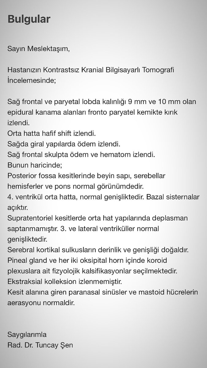 korkmazmelisa_'s tweet photo. @Anabilim_Egitim @tcmeb @CentralTR @saglikbakanligi @norosirurji https://t.co/tGlJ1ACq1y