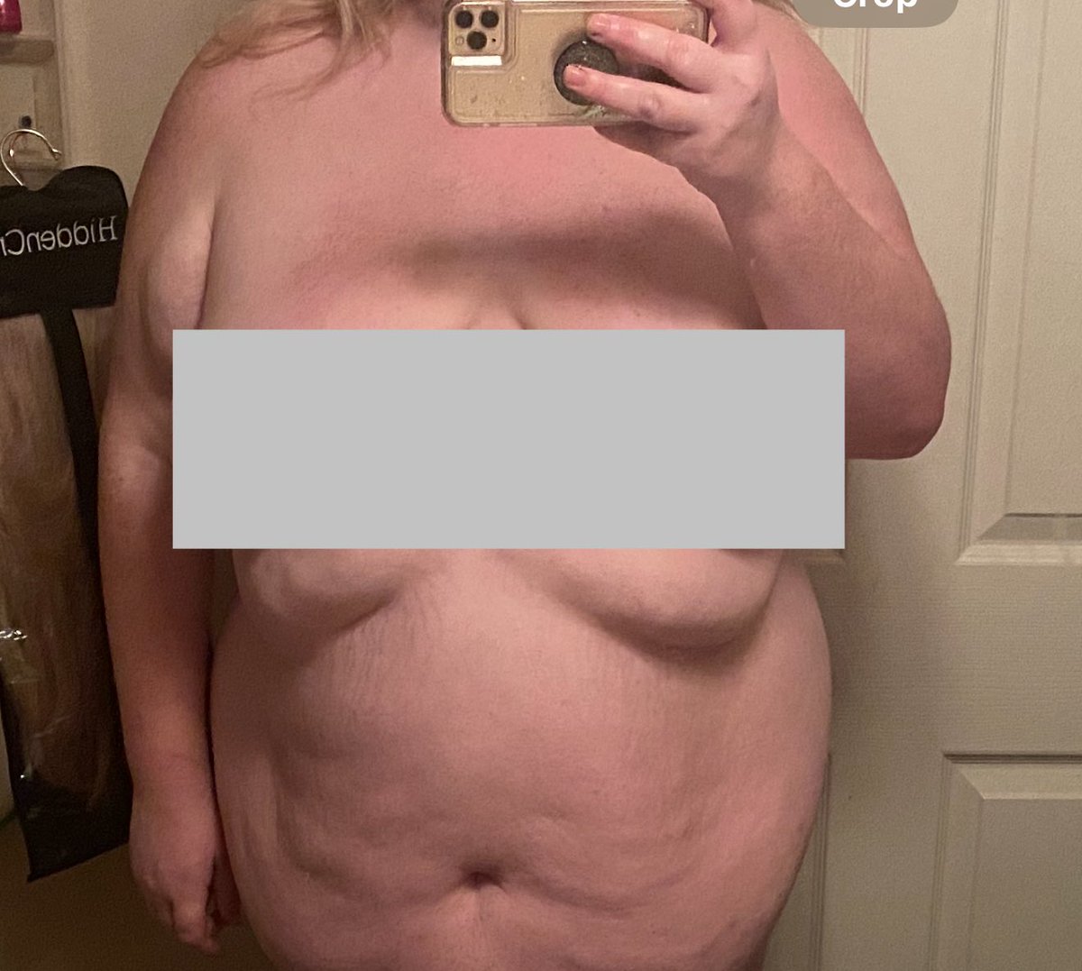 PatsKam's tweet photo. I wish I never let my body get fat. I hate that I had to spend thousands of dollars to fix the damage I had done after finally losing the weight, but I am also damn proud of who I am because of it all. 

Before weight loss, after loss, after skin removal, and healed (today) ❤️ https://t.co/u0RUdRN3tm