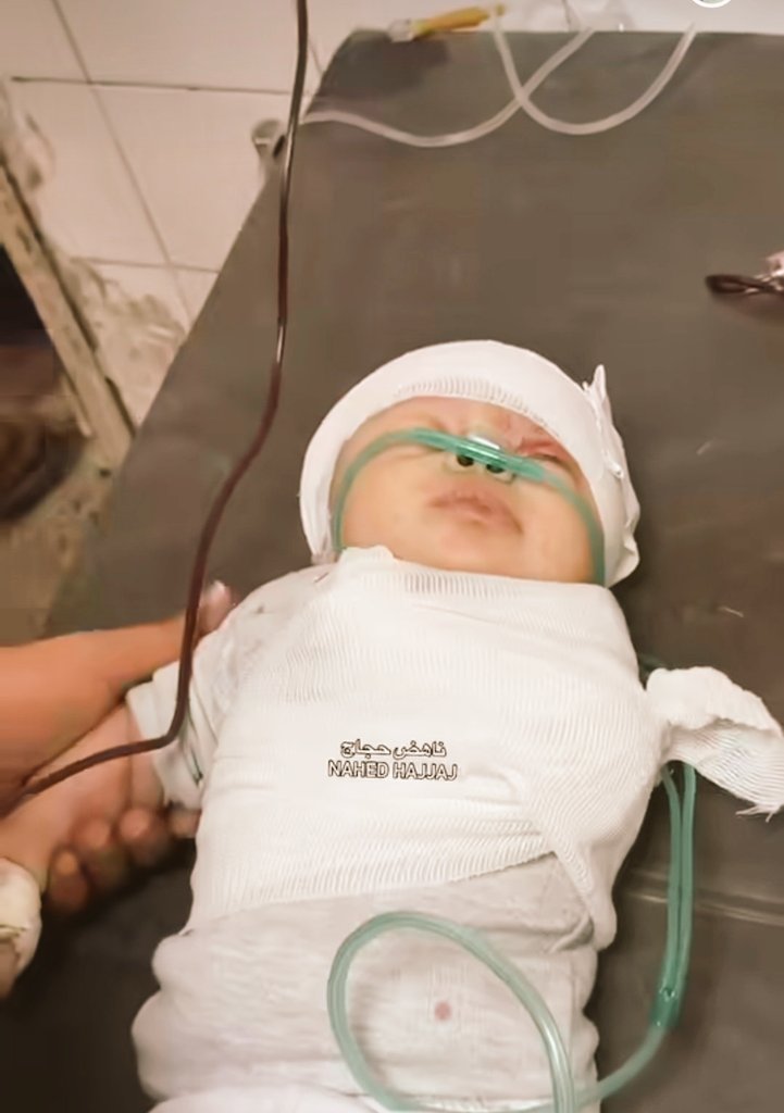 نه می دونه درد چیه!
نه می دونه دست چیه!
نه می دونه جنگ چیه!
حتی بلد نیست بگه آخ!
ولی اینا دلیل نمیشه با تمام وجود عذاب نکشه ها...
اوج مظلومیت اینه که دیگه توی غزه حتی داروی مُسکنی پیدا نمیشه...
#دخیلک_یا_رسول_الله 
#فلسطين