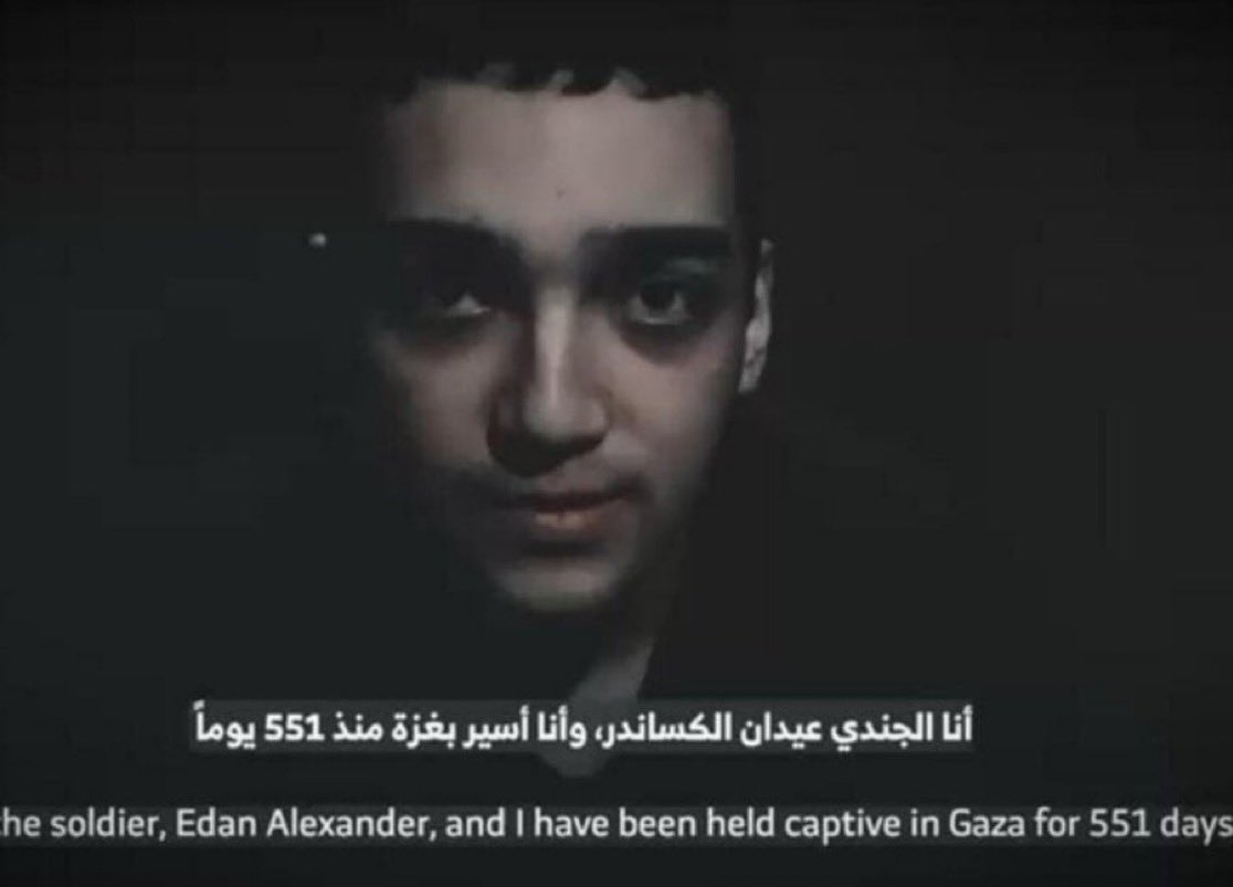 OfficialOJPAN's tweet photo. Sick Monsters. You will rot in hell for this. 

Stay strong Edan. We love you. https://t.co/Ldb7f4YMXL