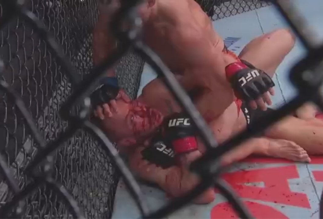 B__urbina's tweet photo. @UFCEspanol #Pimblett es una mรกquina. Top 10 en su divisiรณn ya!๐ฅ๐ฅ๐ฅ๐ฅ๐ฅ๐ฅ๐ฅ #ufc14 https://t.co/HxGXzBlD5B