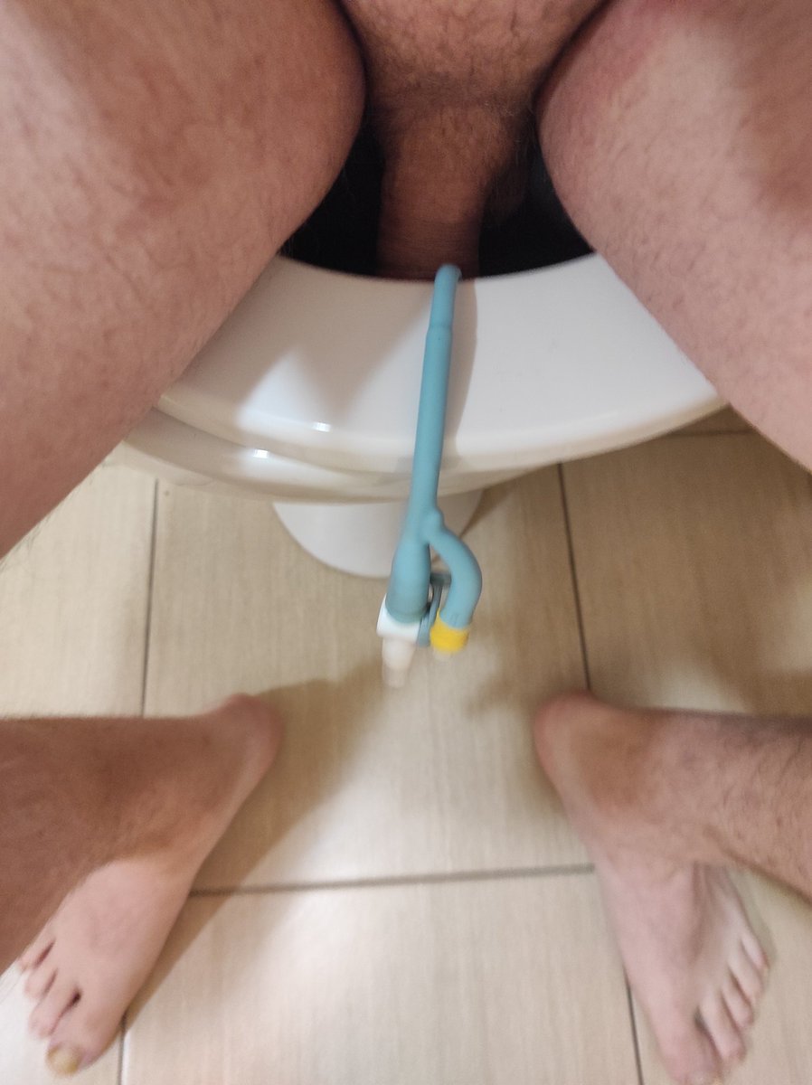 lukas_hospital's tweet photo. The patient has had a permanent urinary catheter Fr 20 SiLaSil in place for more than 14 days. Urine is discharged into the toilet. And how do you deal with urination?
#catheter #patient #fr20 #silasil https://t.co/HDr1yBGGuF