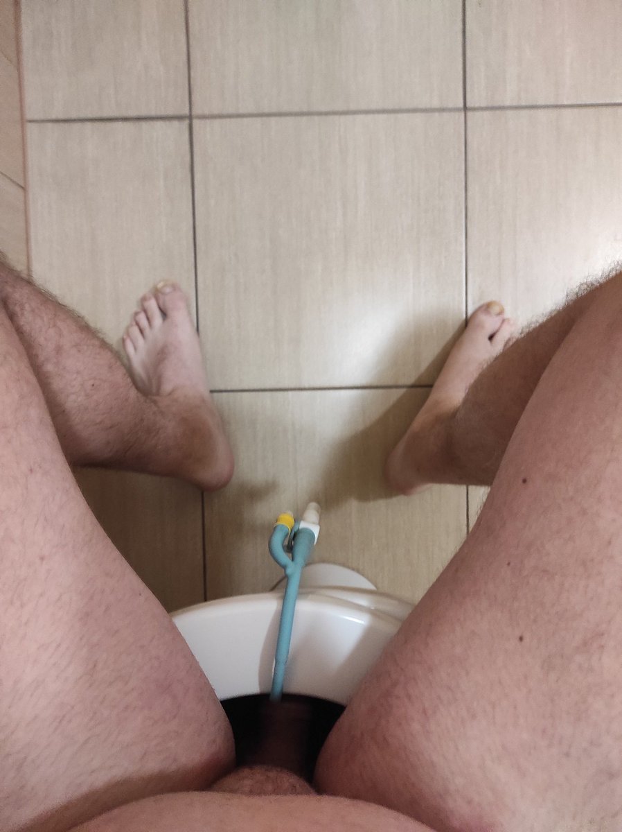 lukas_hospital's tweet photo. The patient has had a permanent urinary catheter Fr 20 SiLaSil in place for more than 14 days. Urine is discharged into the toilet. And how do you deal with urination?
#catheter #patient #fr20 #silasil https://t.co/HDr1yBGGuF