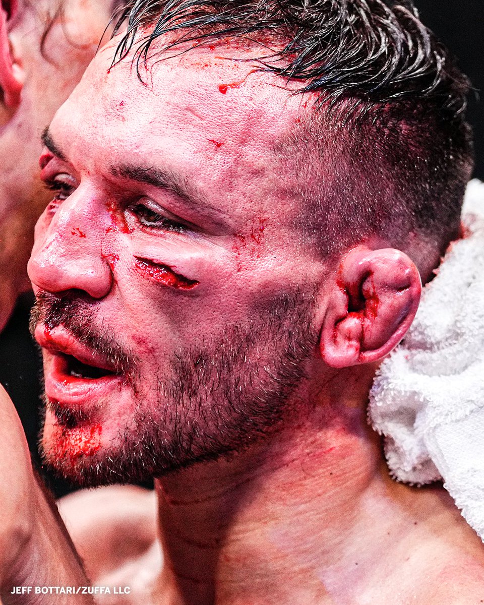 SportsCenter's tweet photo. The cut on Michael Chandler's face from his fight vs. Paddy Pimblett 😮 #UFC314 https://t.co/Gd3NwECFSa
