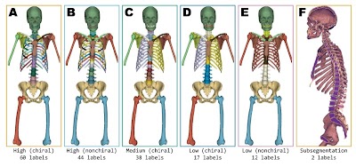 Radiology: Artificial Intelligence (@radiology_ai) on Twitter photo Skellytour: #MachineLearning model for bone segmentation using whole-body CT images doi.org/10.1148/ryai.2… <a href="/uamshealth/">UAMS Health</a> #MSKRad #segmentation #DeepLearning Skellytour: #MachineLearning model for bone segmentation using whole-body CT images doi.org/10.1148/ryai.2… <a href="/uamshealth/">UAMS Health</a> #MSKRad #segmentation #DeepLearning