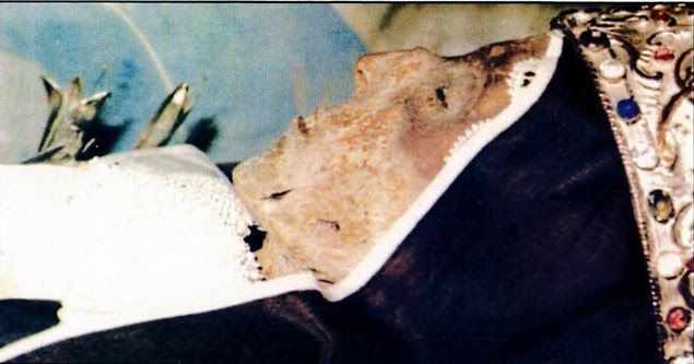 catholicnews1's tweet photo. St. Margaret of Castello was Abandoned by her Parents due to Disabilities - #Incorrupt Patron Saint of Disabled, Pro-Life, Unwanted, the Ugly with Prayer - Saint April 13
https://t.co/TP8zlOy7ET https://t.co/U532g4iEoP