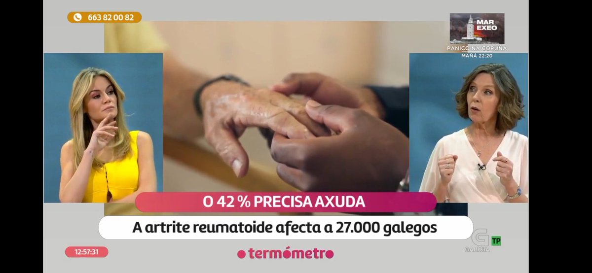 Asearpo's tweet photo. Fantástica intervención da Dra.@ry_susana xefa do servicio de reumatoloxía @ponsalsergas falando da #artrite no programa "O Termómetro" da @TVGalicia  presentado por @RocioDelgadoP_ 
A partires de min 01:14:52 neste enlace 👇
https://t.co/34hDNfbz23 https://t.co/8IZh301l99