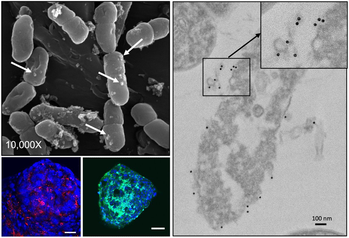DocJZ's tweet photo. I’ve long been intrigued by how the #gut #microbiota influences #immunotherapy in tumors distant from the gut. Today, I’m proud to share our latest discovery https://t.co/4twayjh5c5 — demonstrating that bacteria-derived extracellular vesicles mediate this effect. 
@NatureComms https://t.co/7trrAzUCtK