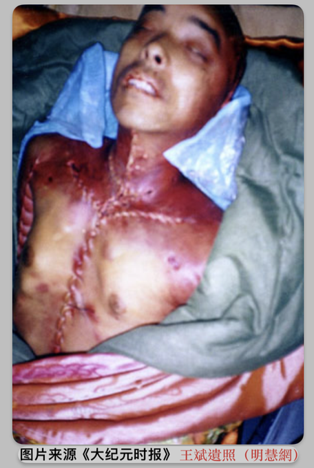 KevinGreen387's tweet photo. The organ harvesting and murder cases in mainland China are led by the evil Chinese Communist Party, which has mobilized the entire state apparatus, including the party, government, military, judicial system, and medical institutions across the country to carry out the evil crime https://t.co/Bahik9fFv3
