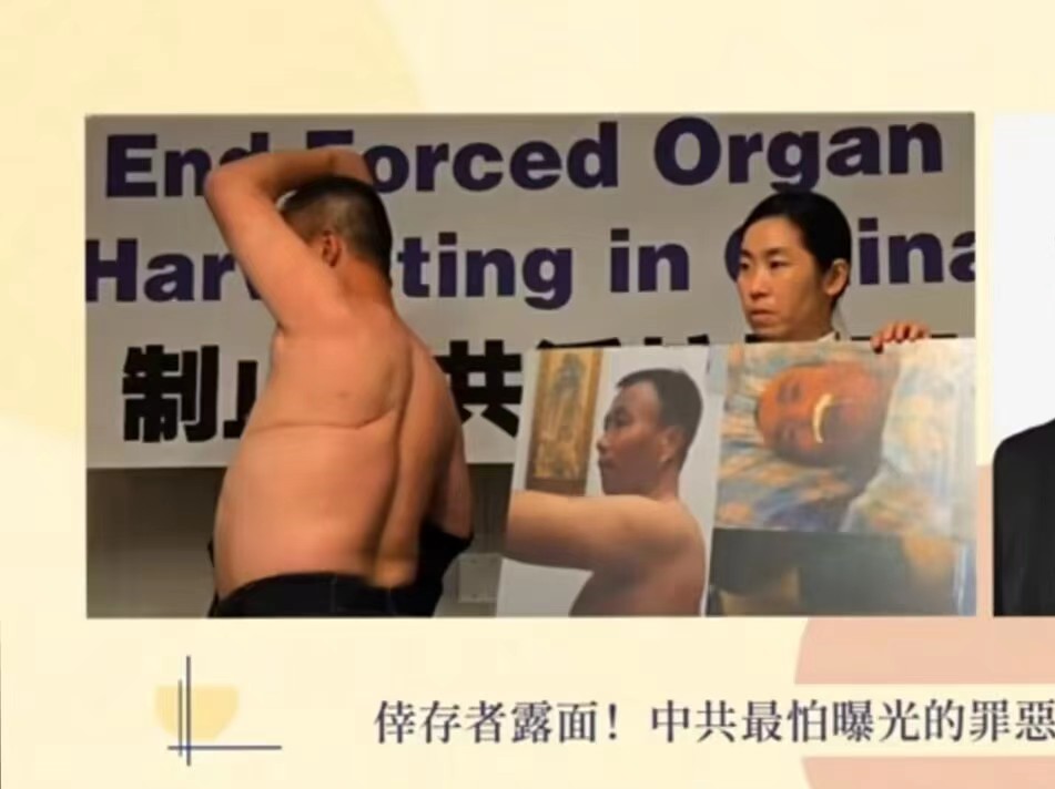 KevinGreen387's tweet photo. The organ harvesting and murder cases in mainland China are led by the evil Chinese Communist Party, which has mobilized the entire state apparatus, including the party, government, military, judicial system, and medical institutions across the country to carry out the evil crime https://t.co/Bahik9fFv3