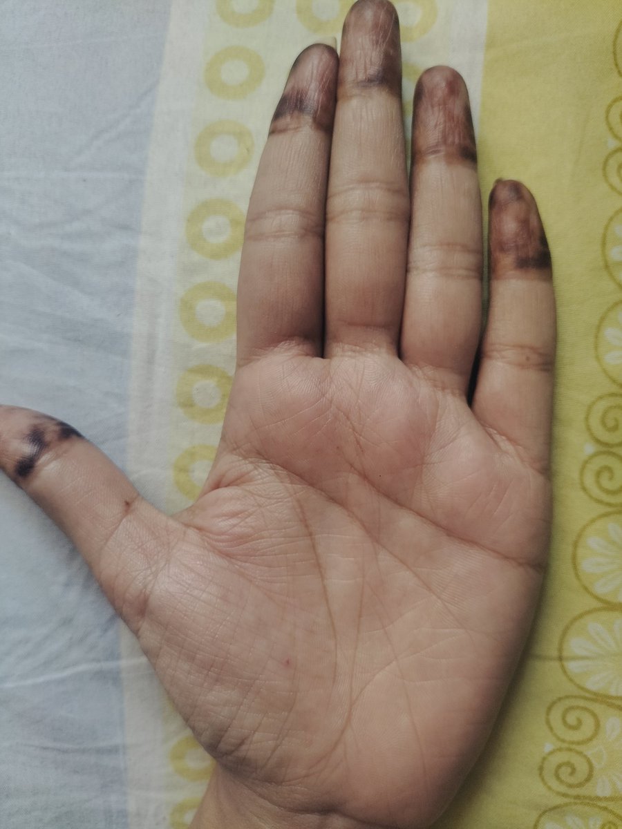 Engineer__hu's tweet photo. @aaadhyatmik मेरे हाथ में है न शायद?? https://t.co/ZaddmyXWsD