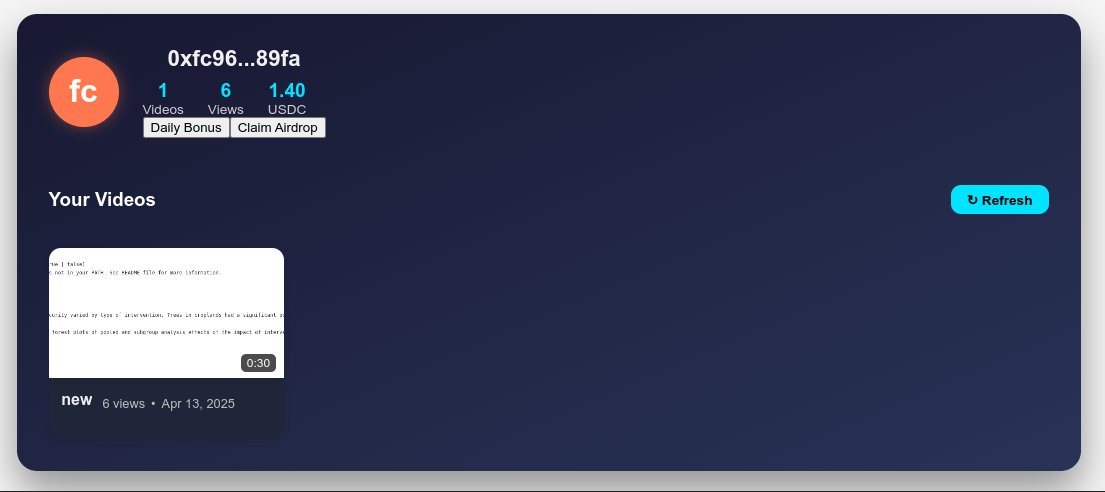 rareniches's tweet photo. Streameth is LIVE on testnet!
Upload videos. Earn USDC. No ads. No middlemen.
π° $0.20/video
π $0.20/daily login
π $5 per 1,000 views
@buildonbase
π₯ Try it here: https://t.co/4lJizLwSwW
π¦ Airdrops for early creators!
#web3 #crypto #streameth #BaseChain #CreatorEconomy https://t.co/dyvilo7xDW