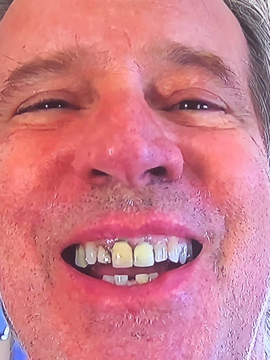 terminal case of huevonitis tweet media