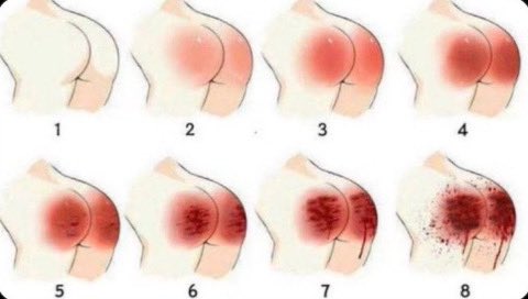 Reply and I’ll tell you how hard I’d spank you 😜😜😜😜😜😜😜😜😜