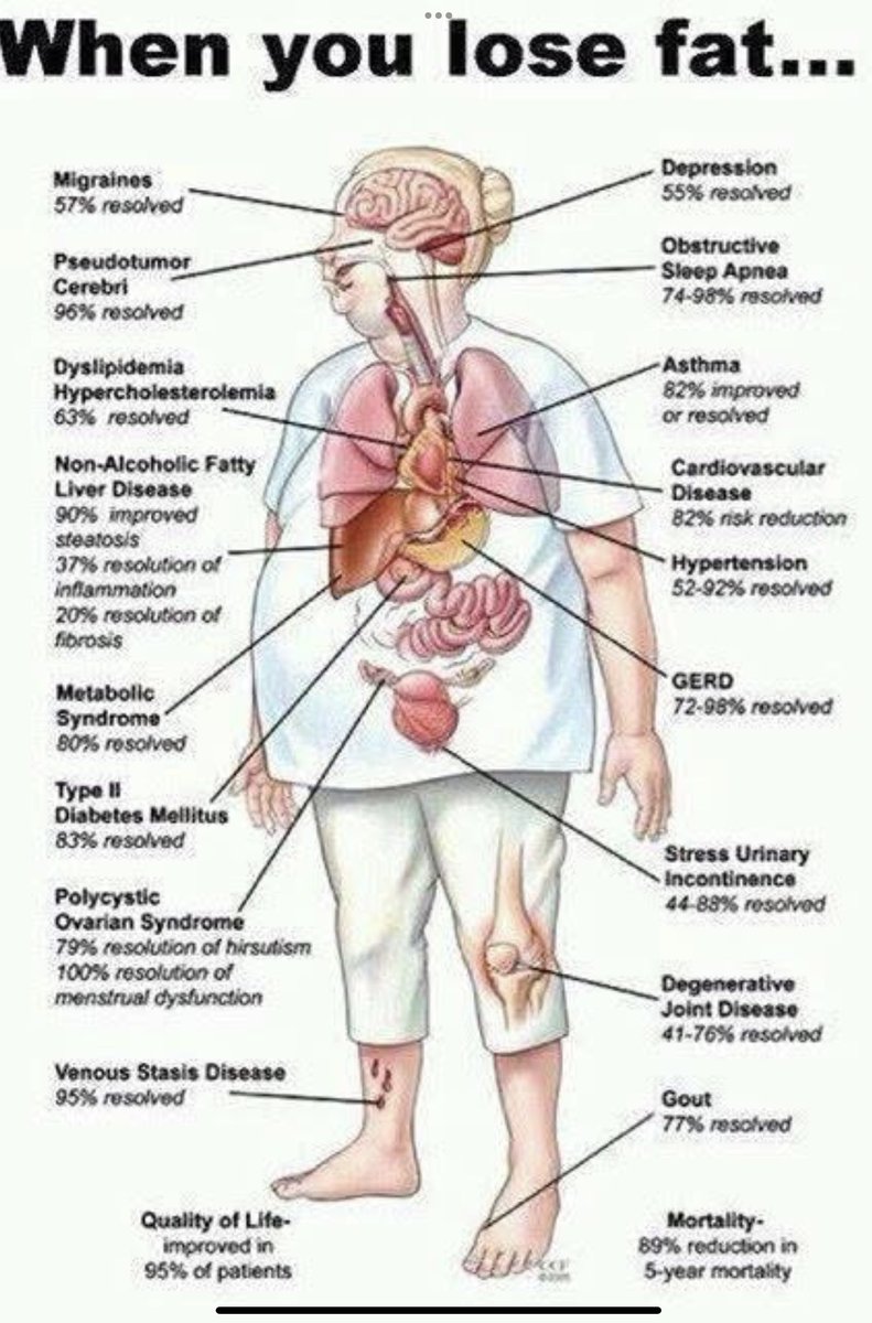 JRowlandMSC's tweet photo. Struggling to shed those extra pounds? 
💡 The benefits go far beyond the scale:
✅ Increased energy levels
✅ Boosted confidence
✅ Improved heart health
✅ Easier movement &amp; flexibility
Start your fat-loss journey today for a healthier, happier you! #FatLossBenefits #Wellness https://t.co/5IIdPEOoN8
