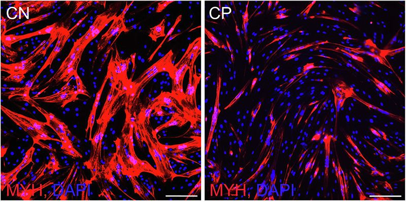ExpertFile (@expertfile) on Twitter photo Researchers laying the groundwork to eventually detect cerebral palsy via blood test
<a href="/UDelaware/">Univ. of Delaware</a> professor hopes this work leads to cerebral palsy being detected at birth.
exprt.co/42klUED Researchers laying the groundwork to eventually detect cerebral palsy via blood test
<a href="/UDelaware/">Univ. of Delaware</a> professor hopes this work leads to cerebral palsy being detected at birth.
exprt.co/42klUED