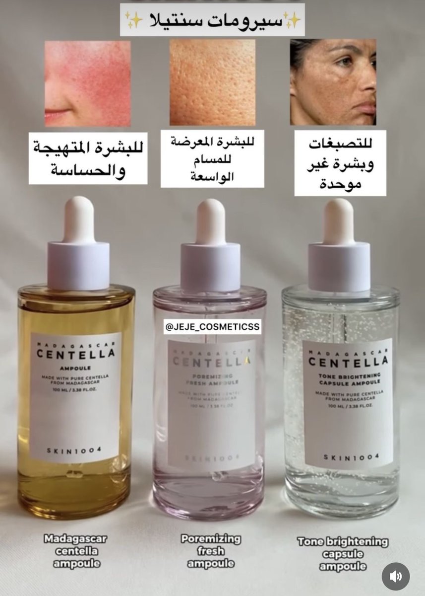 سيرومات سنتيلا الاكثر مبيعًا واستخداماتها: