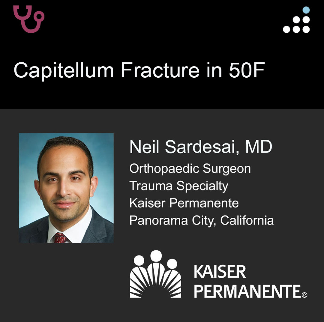 Here are intraop &amp; postop images of yesterday's case by Dr. Neil Sardesai and Kaiser Permanente <a href="/KPSCALnews/">Kaiser Permanente Southern California</a>..

CAPITELLUM FRACTURE IN 50F

PROCEDURE: ORIF OF COMPLETE ARTICULAR DISTAL HUMERUS FRACTURE WITH PROXIMAL ULNA OSTEOTOMY

Here is the link to the clinical presentation and