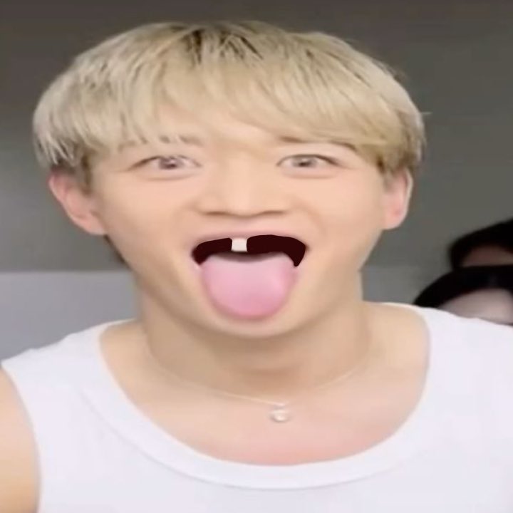 IMAGINE: you come out of your tooth transplant… 

“minho, i’m out alive!” you scream.. 

“who do you fink gave you da teef” he says, smiling
