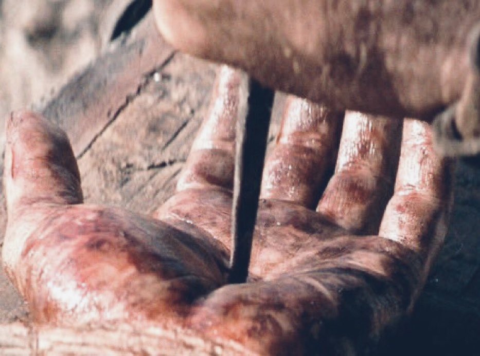 TroyPSilva's tweet photo. Sore arms
Scabs from sliding
Blistered hands from hitting
HBP bruises
All don't seem so bad when we remind ourselves what Jesus did for us on that cross!!!
Thank you Jesus for taking the nails for us!🙏🏽
1 cross + 3 nails = 4 given