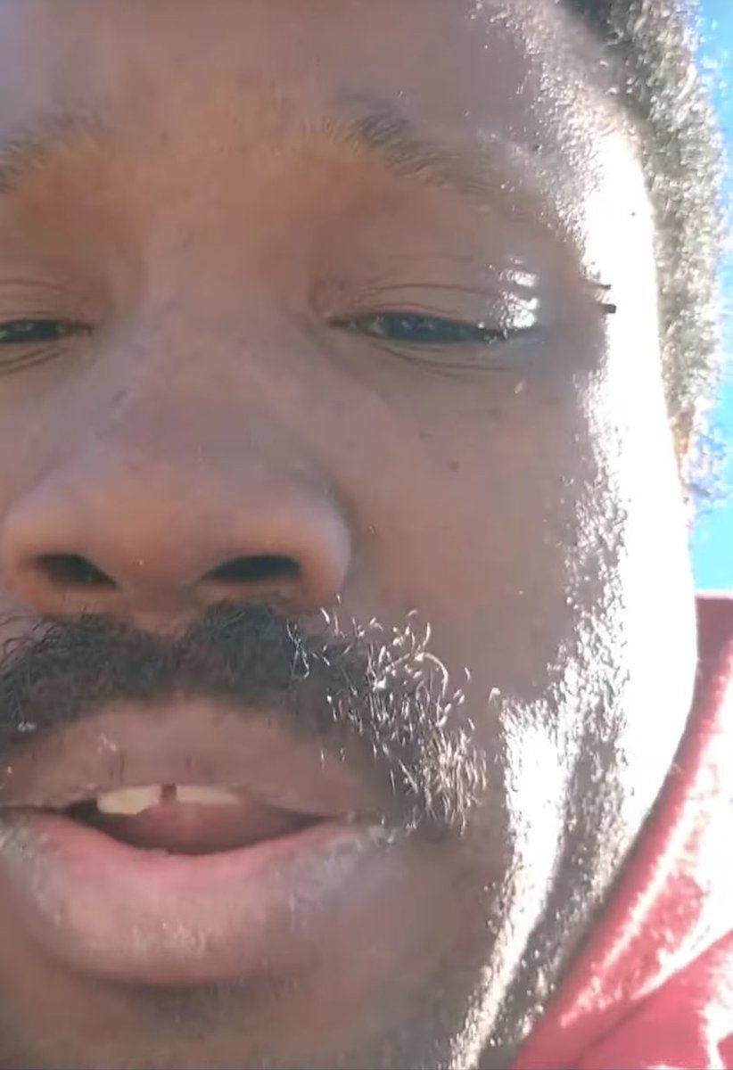 MarshalGrey87's tweet photo. @LegendGuy328 @Orphenkryscion @Redsow4 Says homeless bum with overgrown nails, oral thrush, several skin tags on his face with eyes that say “fetal alcohol syndrome”? Nigga, shut up. https://t.co/aOba4ksk8a