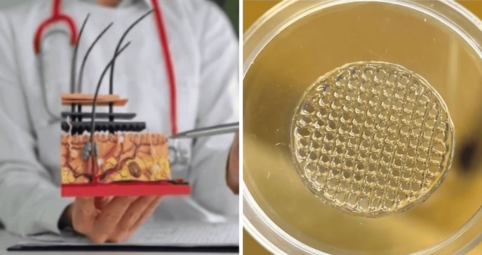 maxilolapaz's tweet photo. 🔹Científicos crean piel humana impresa en #3D xa reemplazar pruebas cosméticas en animales, vía @RevistaMSP 

🔸https://t.co/LMybPRaruJ

#MAXILOLAPAZ #Laboratorio3D #bioetica #biomedicina #biologíamolecular #bioimpresion #biologiacomputacional #epigenetica #medicinaregenerativa https://t.co/lY4L5UFaN1