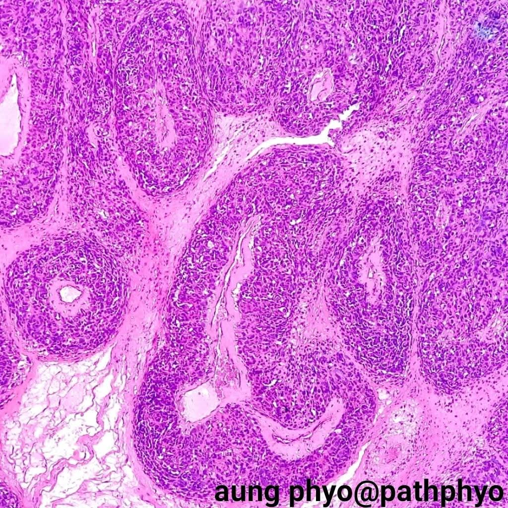 aung phyo tweet media