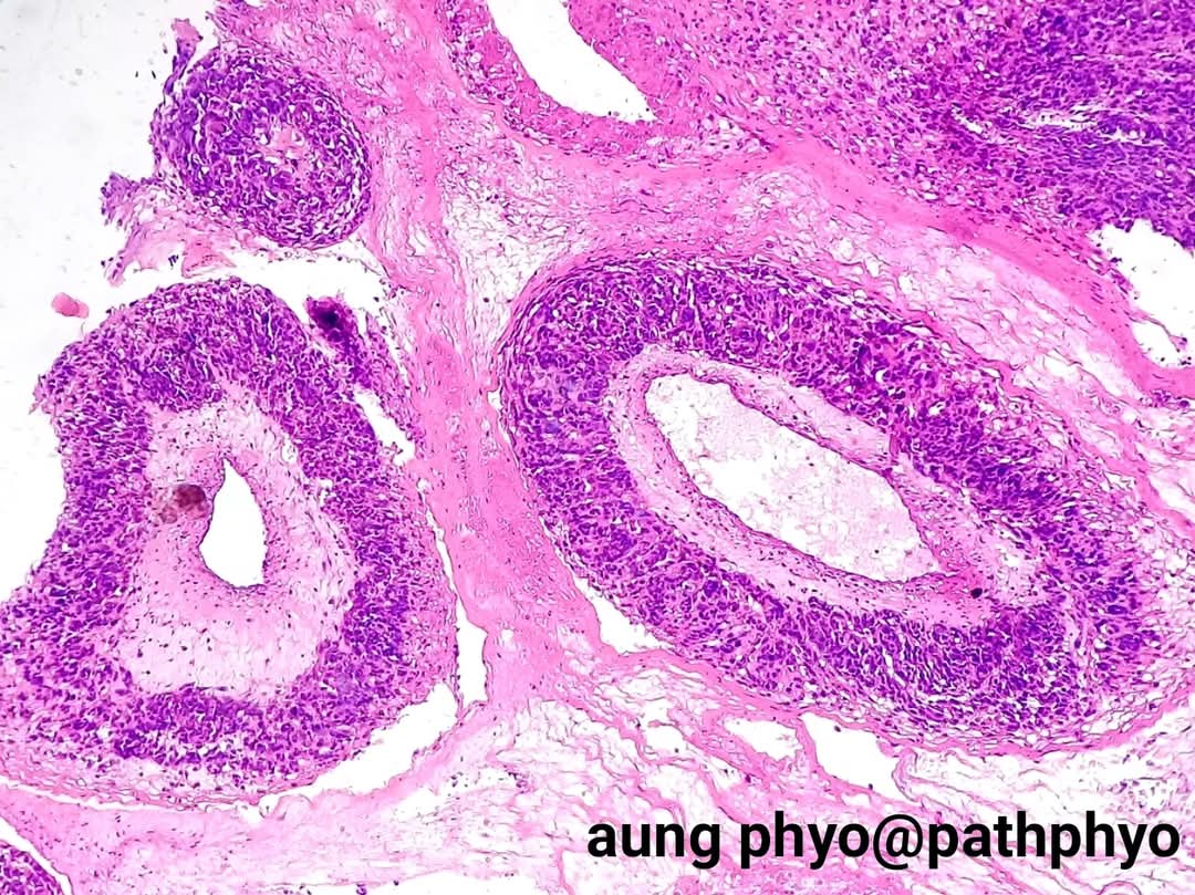 aung phyo tweet media