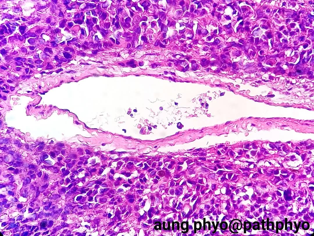 aung phyo tweet media