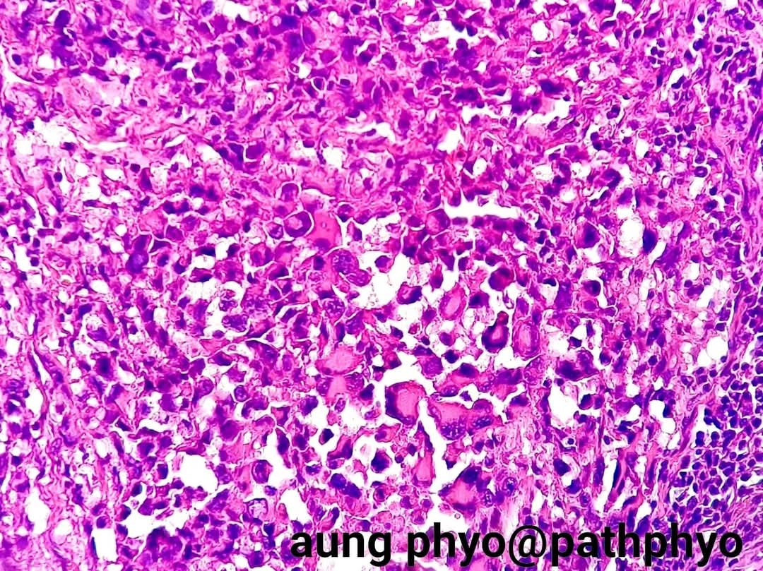 aung phyo tweet media