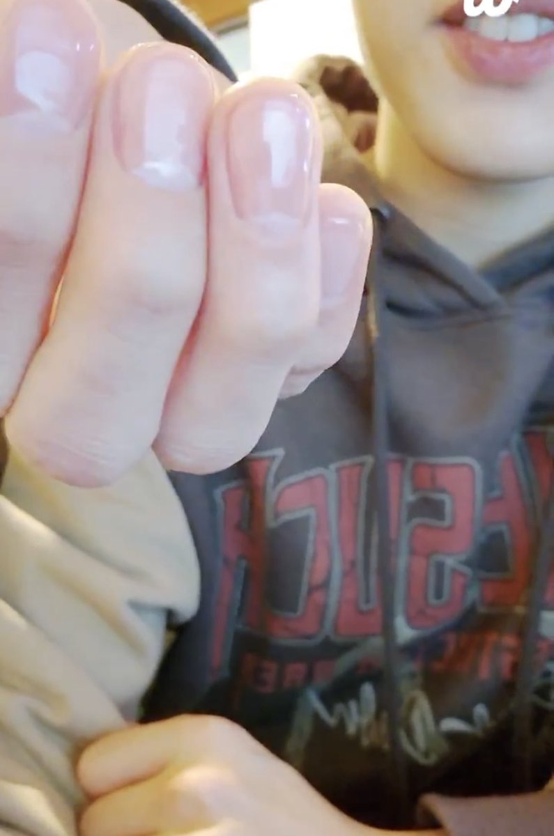HYUNJAE GOT A HELLO KITTY MANICURE????