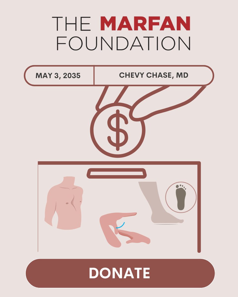 Raisa_Rauf's tweet image. Hi, Please consider donating to our team! We're hoping to fund research for connective tissue disorders and would appreciate anything you are able to give. Below is the link and a flyer I made:
give.marfan.org/team/652696
@PSponsellerMD
@HopkinsOrtho
@AllChildrens