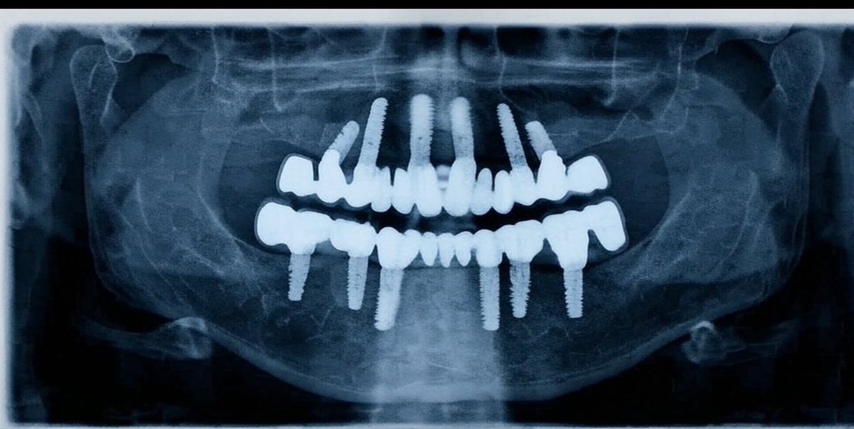 Zahnarzt Basel - English Dentist - Dr. Bonsall tweet media