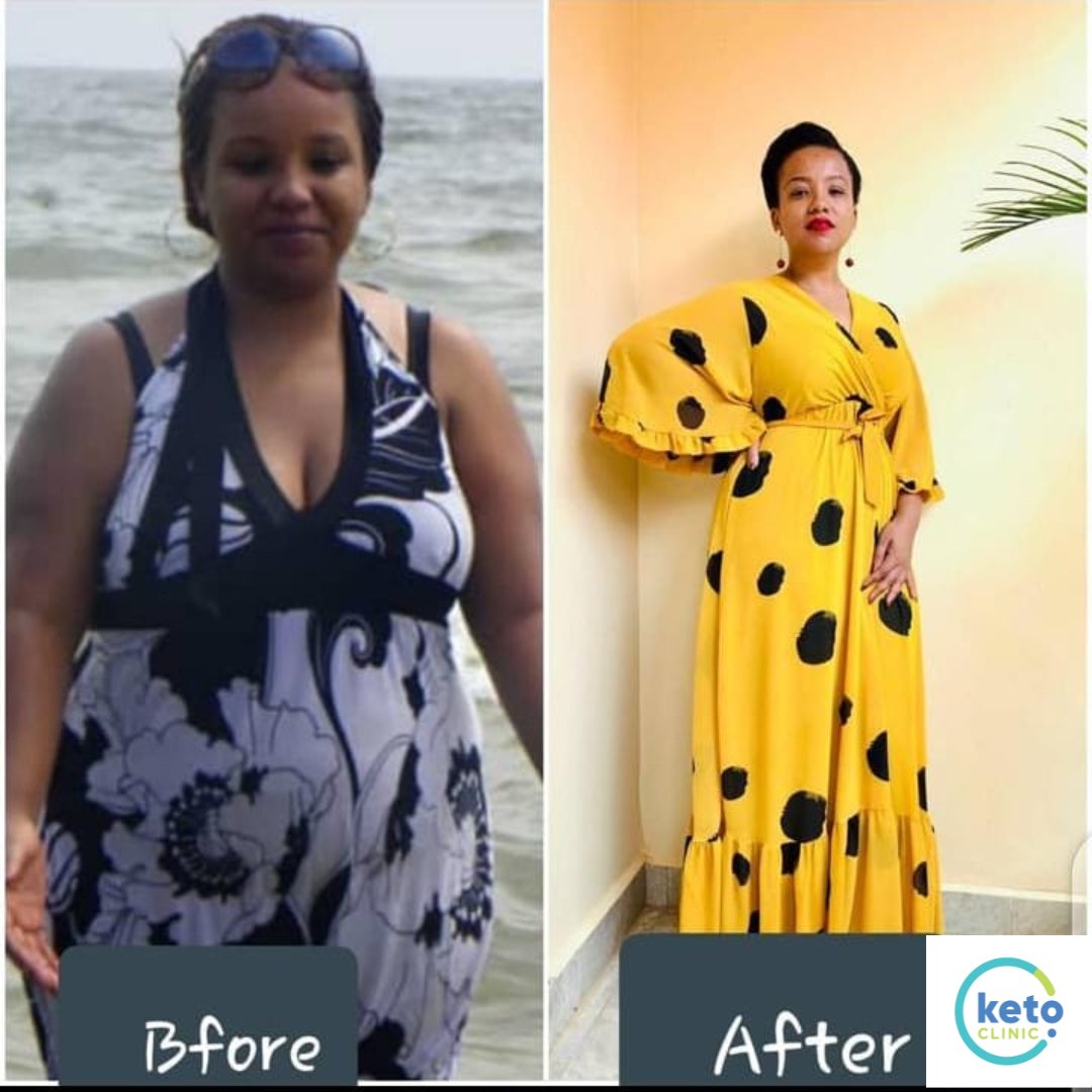 Rogers Balamaga (@rbalamaga) on Twitter photo Celebrate Easter with the gift of an improved metabolic health.
Up to 25% off <a href="/ketoclinic_ug/">Keto Clinic</a> weightloss programs.
For an appointment, call 0741744444, click bit.ly/book-keto-appo… or WhatsApp: 0744444010 today
Learn more at
ketoclinic.org Celebrate Easter with the gift of an improved metabolic health.
Up to 25% off <a href="/ketoclinic_ug/">Keto Clinic</a> weightloss programs.
For an appointment, call 0741744444, click bit.ly/book-keto-appo… or WhatsApp: 0744444010 today
Learn more at
ketoclinic.org