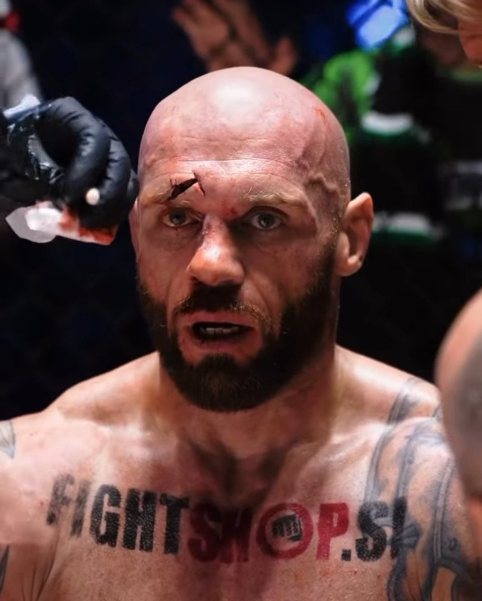 MMA_Balkan's tweet photo. Nasty cut on Bojan Kosendar's head in bareknuckle bout. #FNC22 https://t.co/nWu8K01rVh