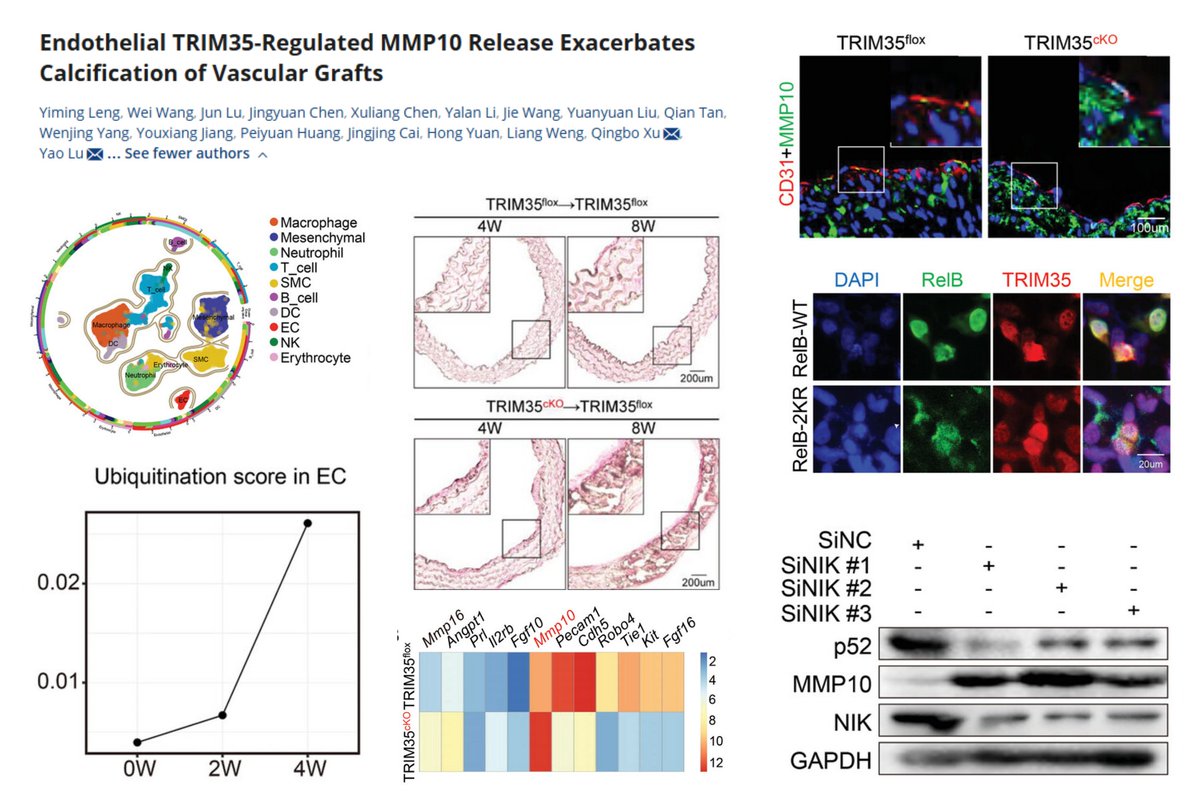 #EndothelialCell to #SmoothMuscleCell communication regulates #MedialArterialCalcification

EC TRIM35 (E3 ligase) KO➡️
⏬K63-Ub RelB (NFκB subunit)➡️
⏫MMP10 expression/secretion➡️
⏫SMC #Osteogenesis

EC Ubiquitination transcript score⏫in🐭transplant aortic isograft

#UKBiobank