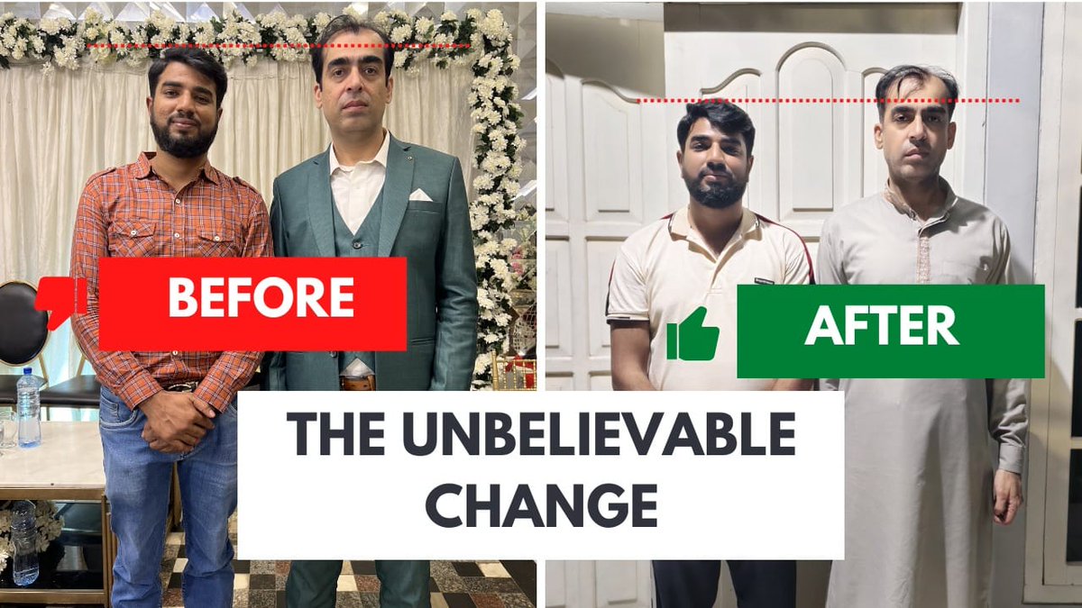 Muhammad Qasim’s body is changing.
🔹 Height ↑ 2 cm
🔹 Feet elongating
🔹 Hair follicles sprouting on forehead
And he says it was all shown to him in dreams…

#LookAtQasimElon
<a href="/elonmusk/">Elon Musk</a>, could this be a new human phenomenon?
#QasimsSigns #MuhammadQasim