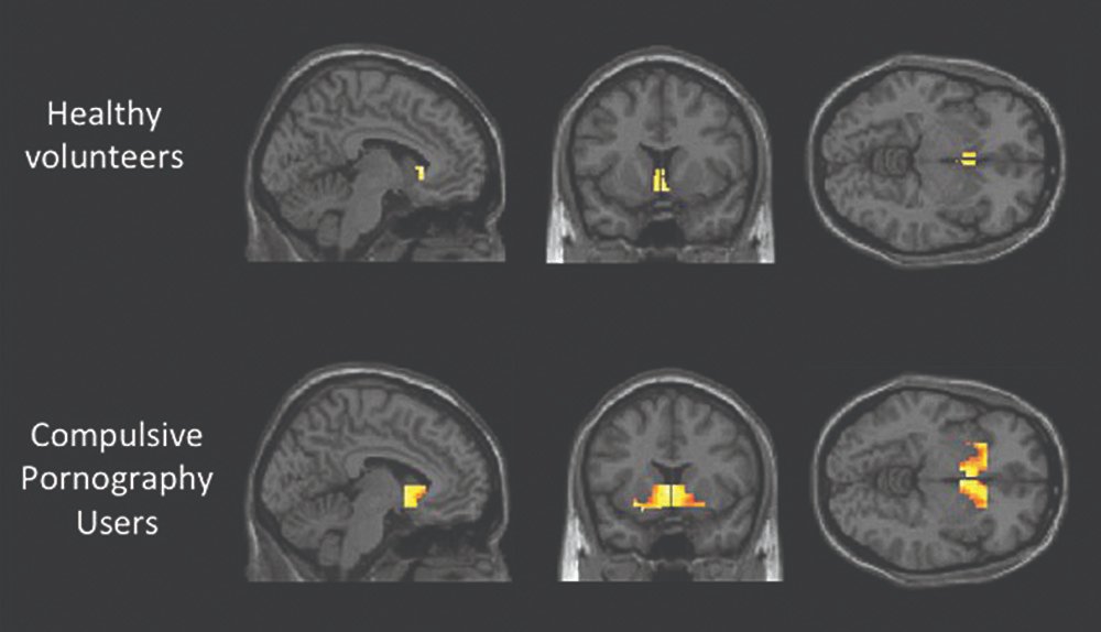 Tenía 15. Ahora tengo 23.

Y perdí 6 años de mi vida viendo p0rno.

Llevo más de 2 años limpio.

Y si todavía estás atrapado en eso…

Aquí van 15 razones brutales para dejarlo antes de que sea demasiado tarde:

// HILO // 🧵
