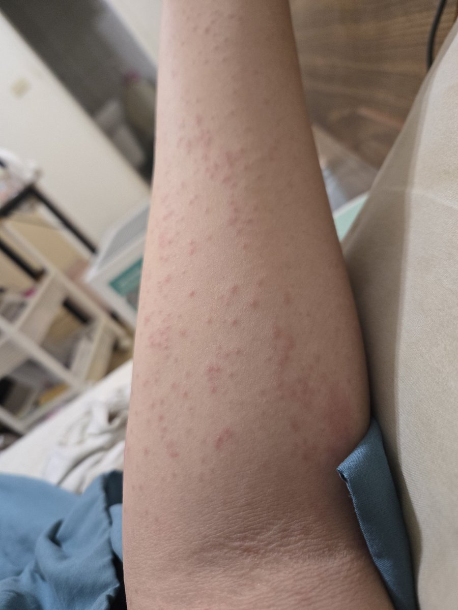 勤美的毛毛蟲好可怕
（照片是手）