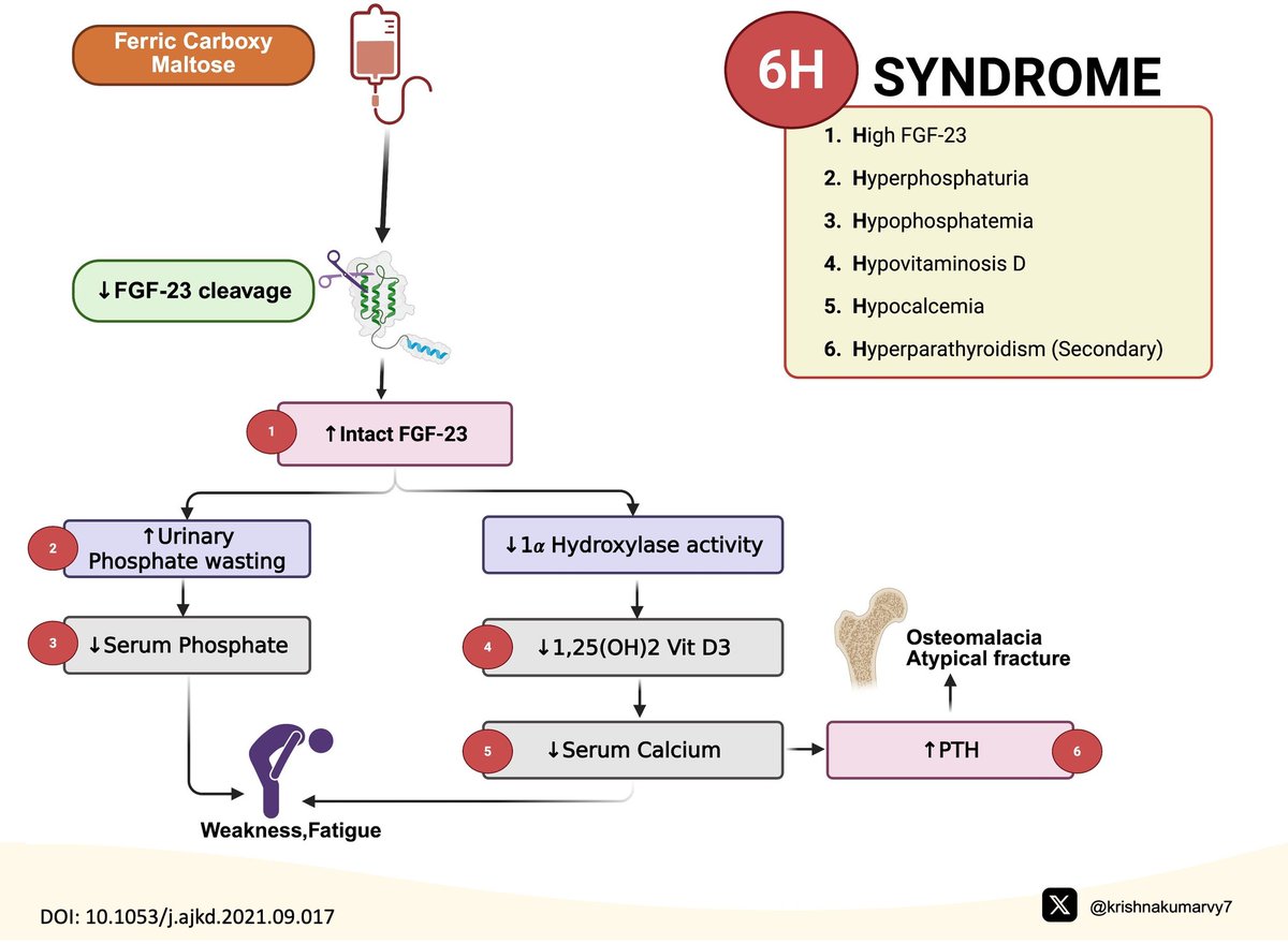 VR.Krishnakumar (@krishnakumarvy7) on Twitter photo Ferric carboxy maltose 6H syndrome #Ivirontherapy #CKDanemia <a href="/aarthi_dr/">Aarthi Muthukumaran</a> <a href="/AnnaGaddy/">BeanQueen Gaddy</a> <a href="/balwani__manish/">Manish Balwani</a> @Dr_Aravind_P_MD <a href="/dr_sourabha/">Sowrabha Rajanna</a> <a href="/dra_miliflores/">Milagros Flores</a> <a href="/drpriyajohn/">Priya John🇮🇳</a> <a href="/drpriyajohn/">Priya John🇮🇳</a> <a href="/elbaonelida/">Elba Medina</a> <a href="/happiedoc/">Subashri</a> <a href="/hardik4u24/">Dr. Hardik Patel 🩺💉</a> <a href="/priti899/">Dr Priti MD,FASN🇮🇳 (प्रिति)</a> Ferric carboxy maltose 6H syndrome #Ivirontherapy #CKDanemia <a href="/aarthi_dr/">Aarthi Muthukumaran</a> <a href="/AnnaGaddy/">BeanQueen Gaddy</a> <a href="/balwani__manish/">Manish Balwani</a> @Dr_Aravind_P_MD <a href="/dr_sourabha/">Sowrabha Rajanna</a> <a href="/dra_miliflores/">Milagros Flores</a> <a href="/drpriyajohn/">Priya John🇮🇳</a> <a href="/drpriyajohn/">Priya John🇮🇳</a> <a href="/elbaonelida/">Elba Medina</a> <a href="/happiedoc/">Subashri</a> <a href="/hardik4u24/">Dr. Hardik Patel 🩺💉</a> <a href="/priti899/">Dr Priti MD,FASN🇮🇳 (प्रिति)</a>