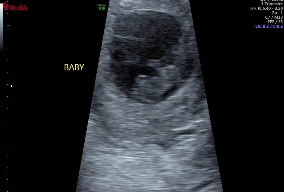 thtgrlMoe's tweet image. Love my little family🩵🩷@dRoseKB