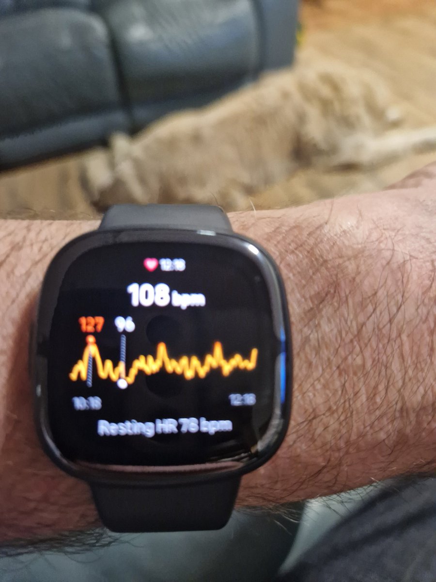 My Afib gone mad. Fitbit tracker