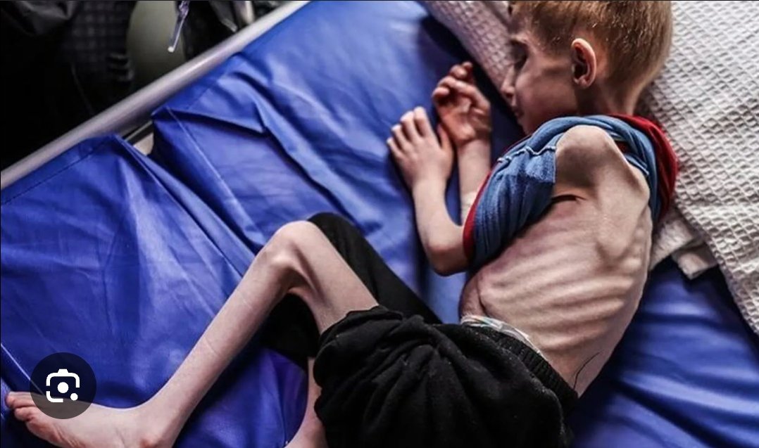 Terrynuriman's tweet photo. “Not even a grain of wheat will enter Gaza.” - Bezalel Smotrich, Israel

This is not war.
This is starvation warfare.
This is what it looks like: https://t.co/U5fs9iMzgH