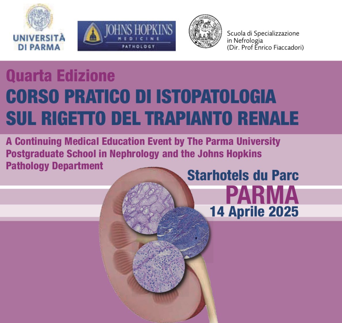 Ilaria Gandolfini (@ilagandolf) on Twitter photo Looking forward to our tomorrow course on renal transplant pathology with Prof Serena Bagnasco and <a href="/NadaAlachkar/">Nada Alachkar</a> from Baltimore!💪🏻
<a href="/DelsanteMarco/">Marco Delsante</a> <a href="/fra_costigliolo/">Francesca Costigliolo</a> <a href="/UMaggiore/">Umberto Maggiore</a> Looking forward to our tomorrow course on renal transplant pathology with Prof Serena Bagnasco and <a href="/NadaAlachkar/">Nada Alachkar</a> from Baltimore!💪🏻
<a href="/DelsanteMarco/">Marco Delsante</a> <a href="/fra_costigliolo/">Francesca Costigliolo</a> <a href="/UMaggiore/">Umberto Maggiore</a>