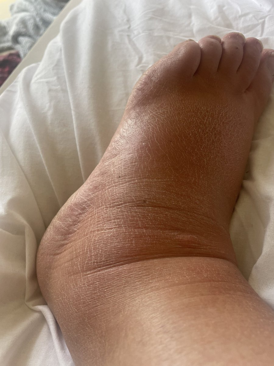 Lara - Covid is Airborne tweet media