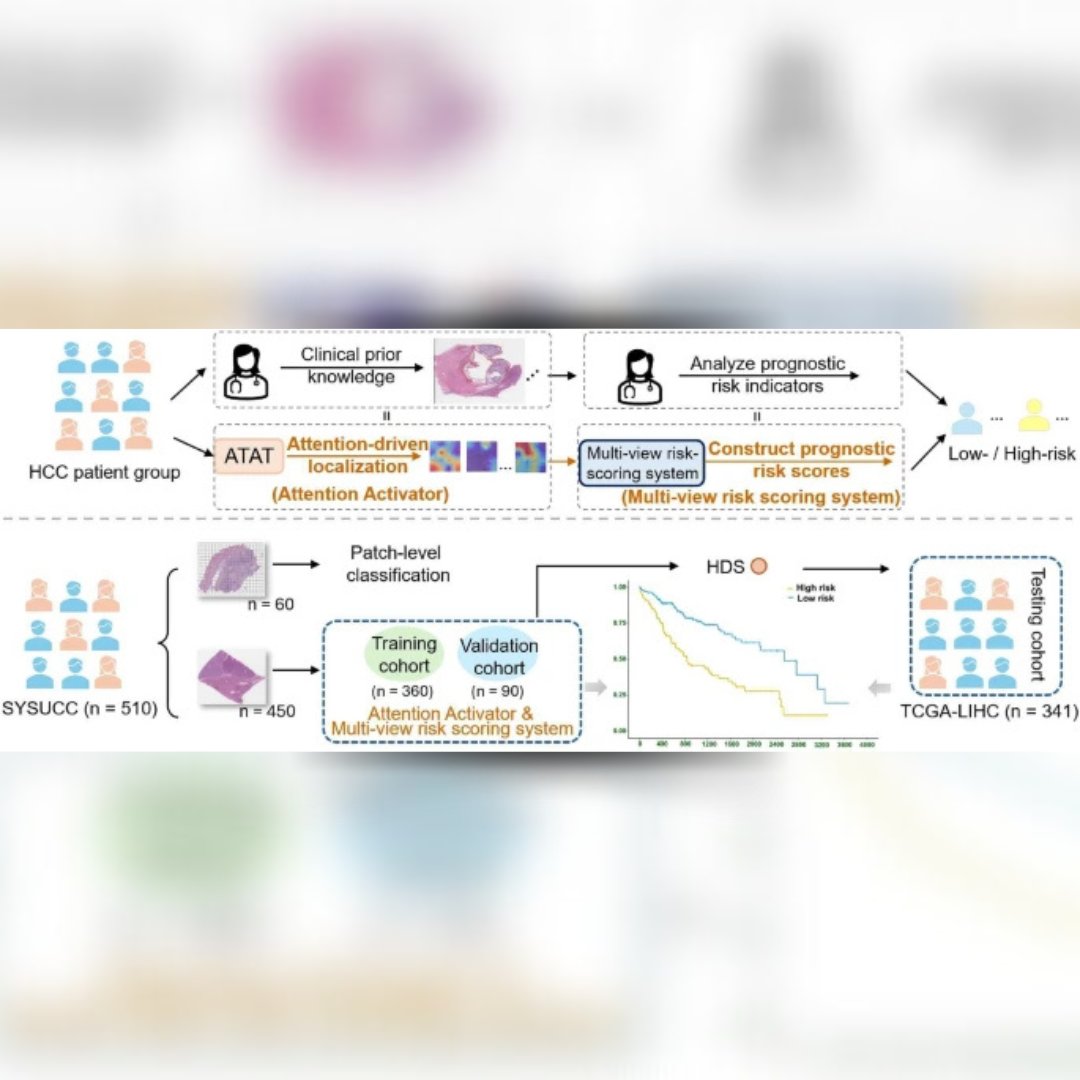 Explore an innovative, data-driven approach to hepatocellular carcinoma care.

A new article in Hepatology International introduces an explainable attention-enhanced heuristic paradigm for multi-view prognostic risk score development in HCC—paving the way for more accurate,